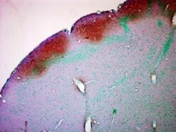 CaMKII alpha/beta, p Thr286, p Thr287 Antibody (22B1), Novus Biologicals